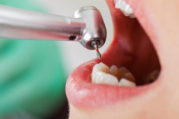 Best Tooth Infection Emergency Dentist  in De Soto, MO